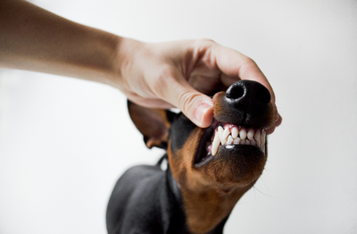 CÓMO EVITAR ENFERMEDADES PERIODONTALES